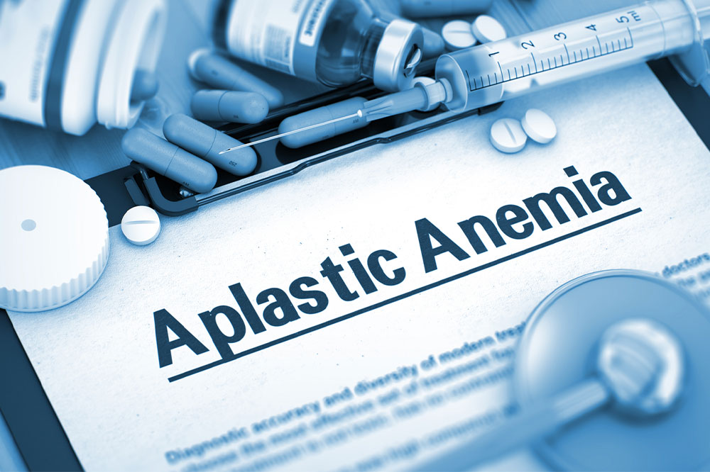 All About Aplastic Anemia