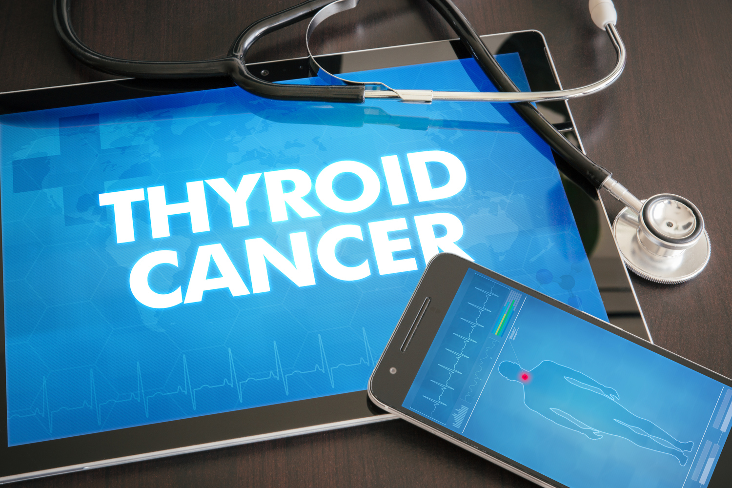 Causes, Risks and Preventative Measures for Thyroid Cancer