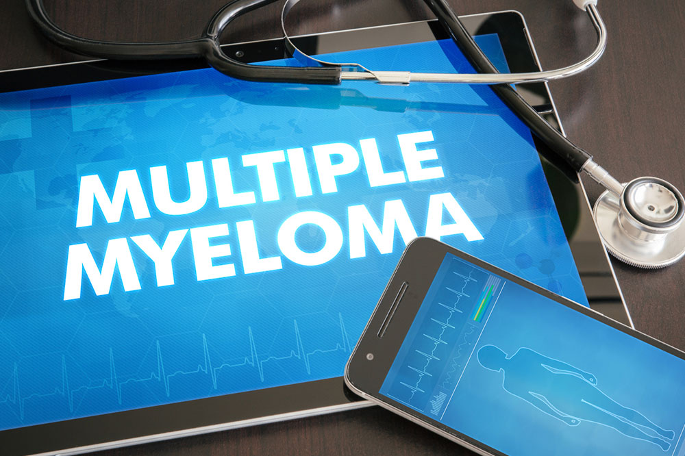 Stages of Multiple Myeloma